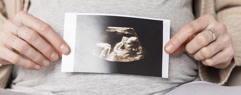 Drehung des Babys im Mutterleib